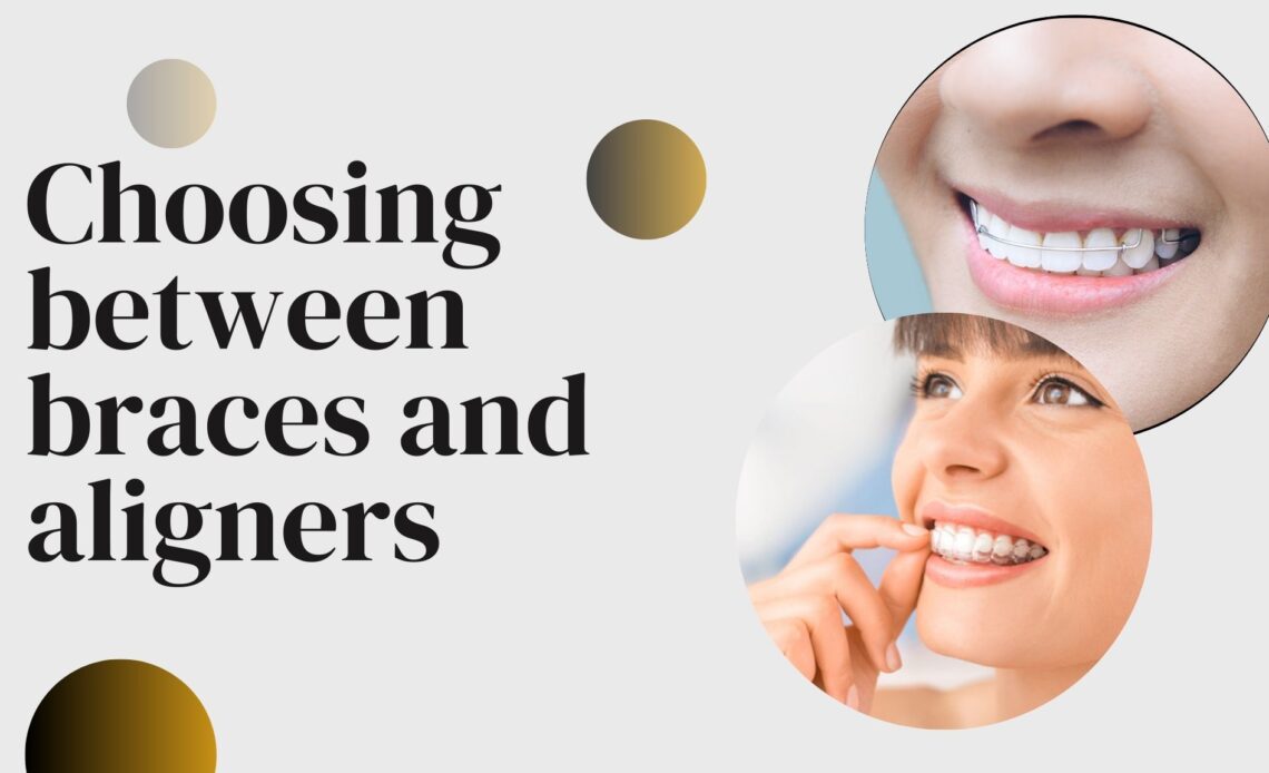Choosing between braces and aligners - Write For Us Technology | Free ...